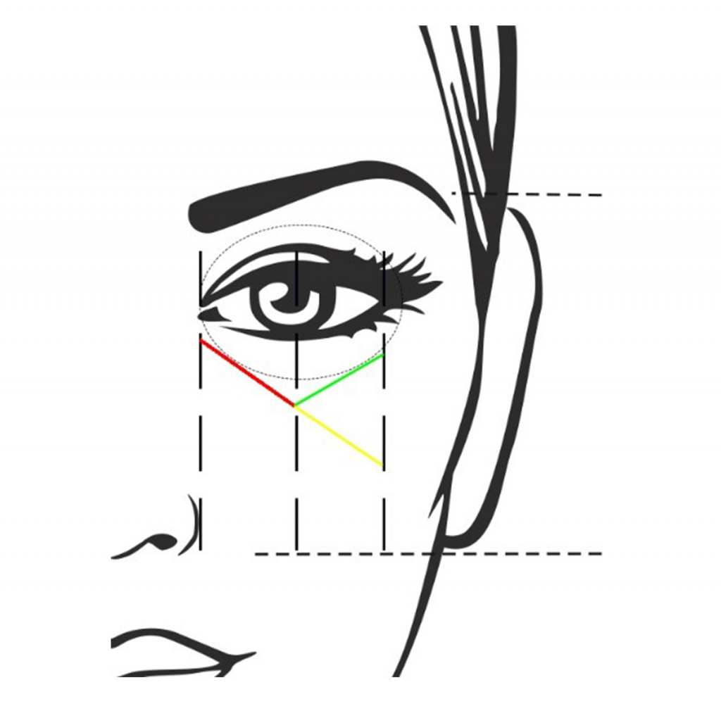 Границы носослезной (красная), пальпебромалярной (зеленая) и среднещечной (желтая) борозд.